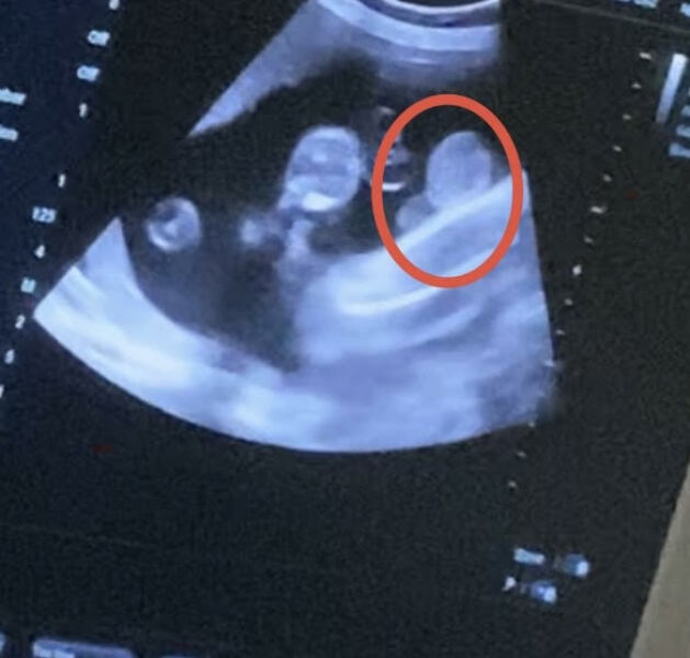 this is boy?