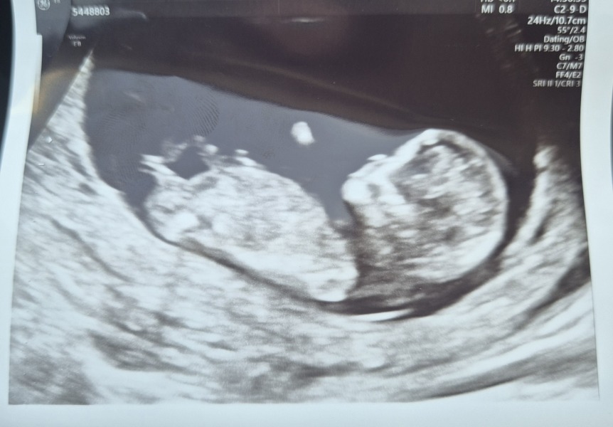 November 2025 #Thread 2 🤰🏻