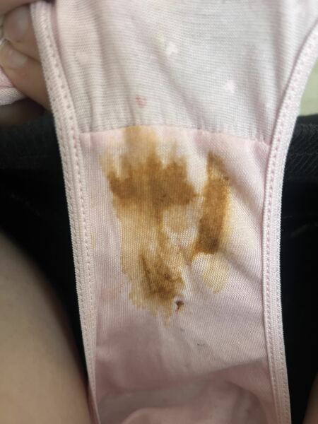 Orange colour period blood? Tw graphic pic