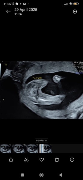 Gender Potty shot doubts? 16+1 weeks