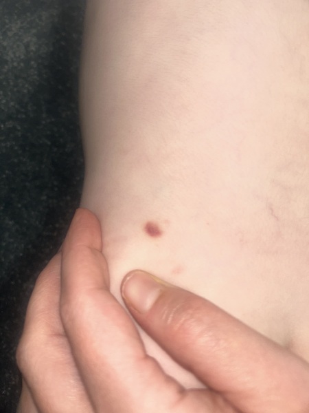 Weird spots 4 year old