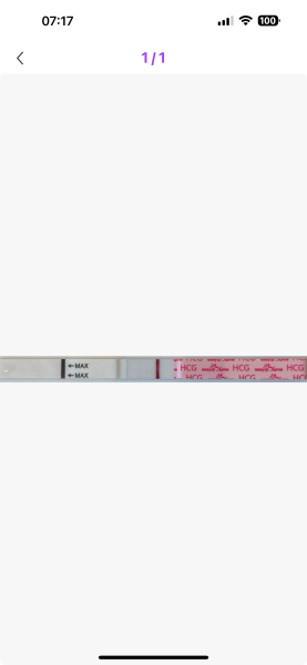 Have I got line eyes??