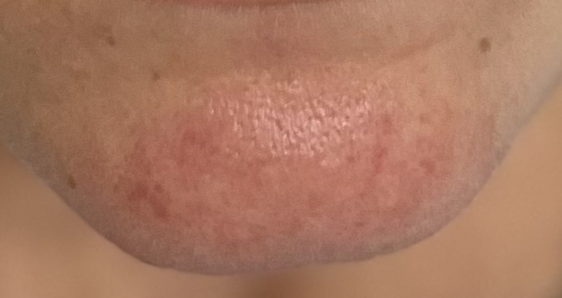 Skincare recommendations (pics!)