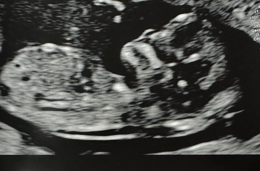Due December 2025
