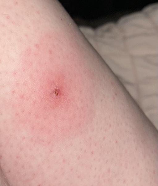 To be worried about this on my leg?