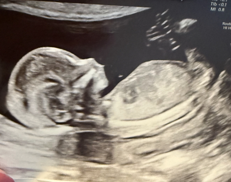 Just for fun guess the gender x