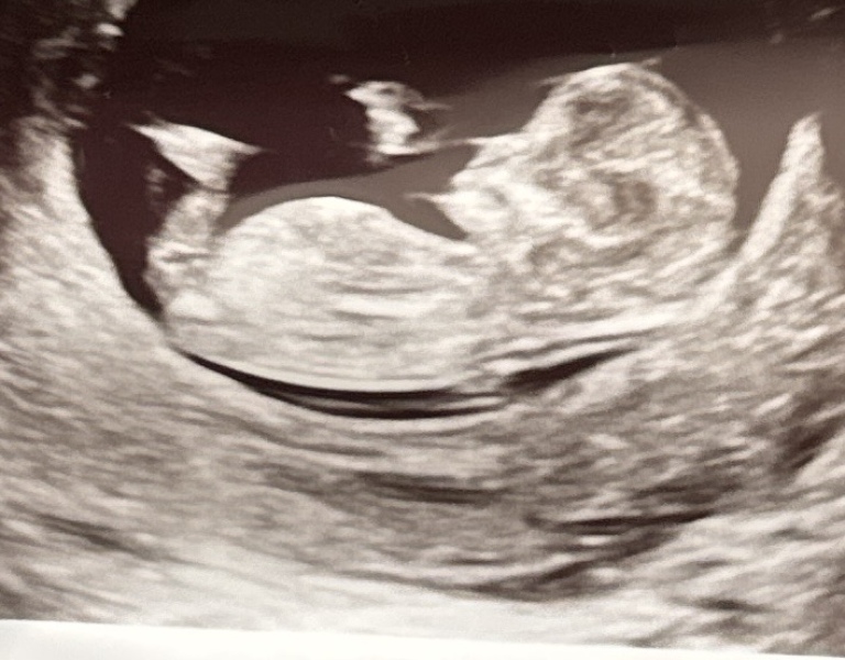 Gender guess