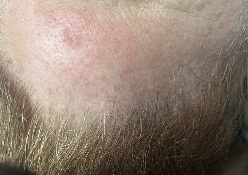 Does this look like a BCC to you? If not, what could it be?