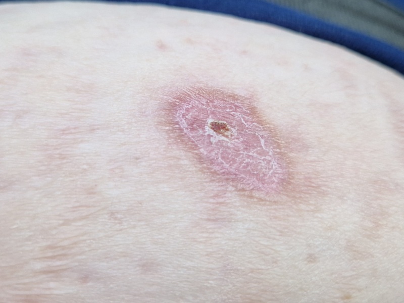 Random raw skin thing - ideas?