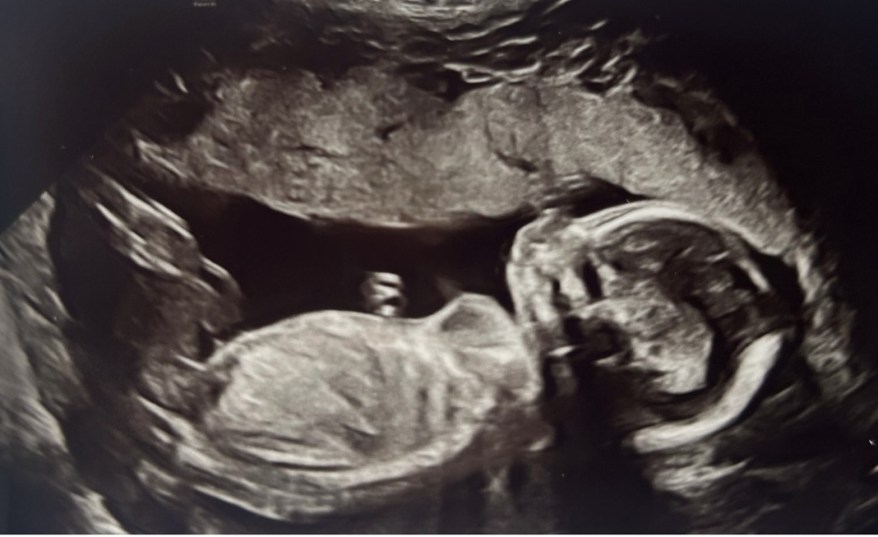 Scan photo