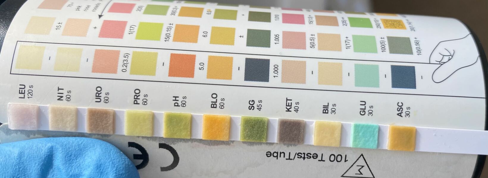 Urine Dip Test - do I need to contact GP?
