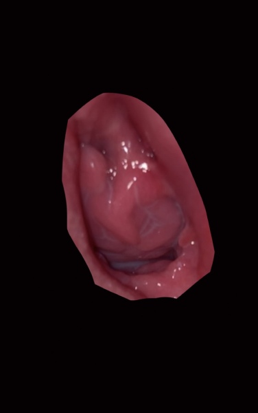 TMI pic - what are these lumps coming out my vagina !?