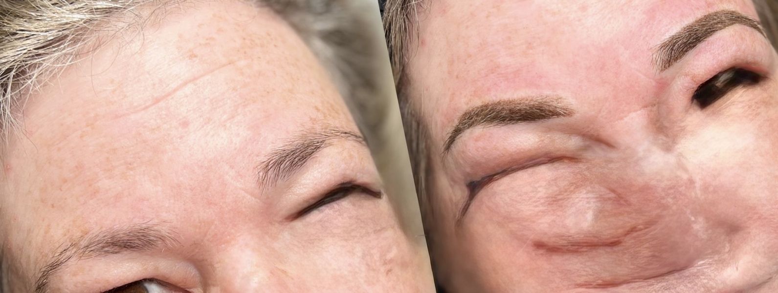 Eyebrows
