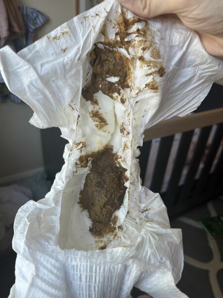 Toddler poop consistency - TW poop photo