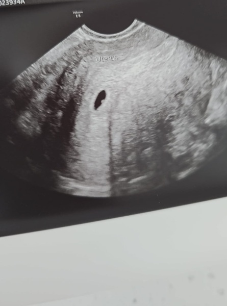 TTC May 2023 💖 Previous MC March 2023 (thread 5)