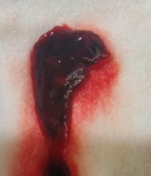 Is this my baby? *Warning graphic pic! *