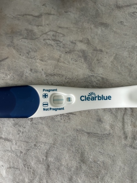 Do I have line eyes?