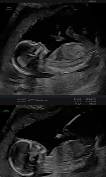 Boy or Girl? 🩵🩷