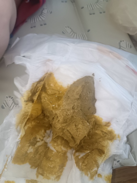 Is this CMPA poo warning poo pic