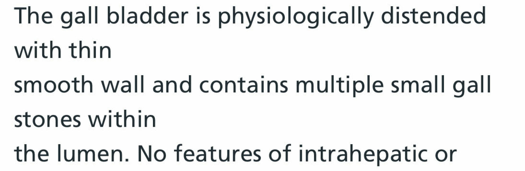 Moun-June-ers 2024 - New Wardrobes, New Lives and Plodding into Maintenance