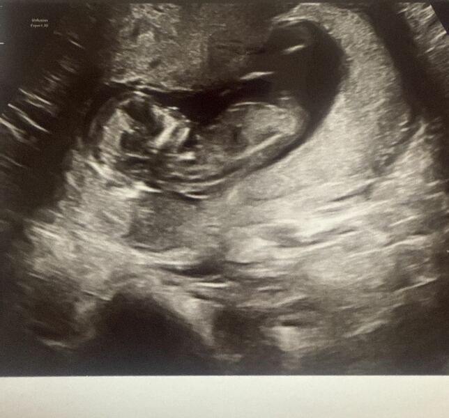 Boy or girl