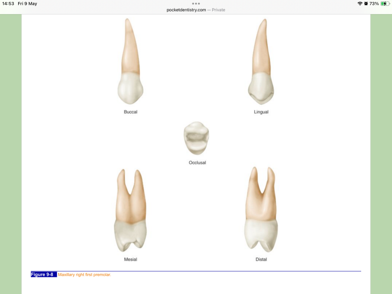 Any dentists around? Could you please tell me if I'm right? Xray