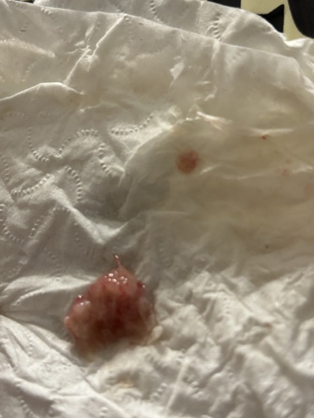 Help - from nose! Pic warning