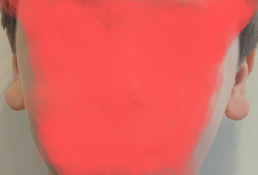 DS (6) earlobes stick outwards