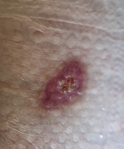 Random raw skin thing - ideas?