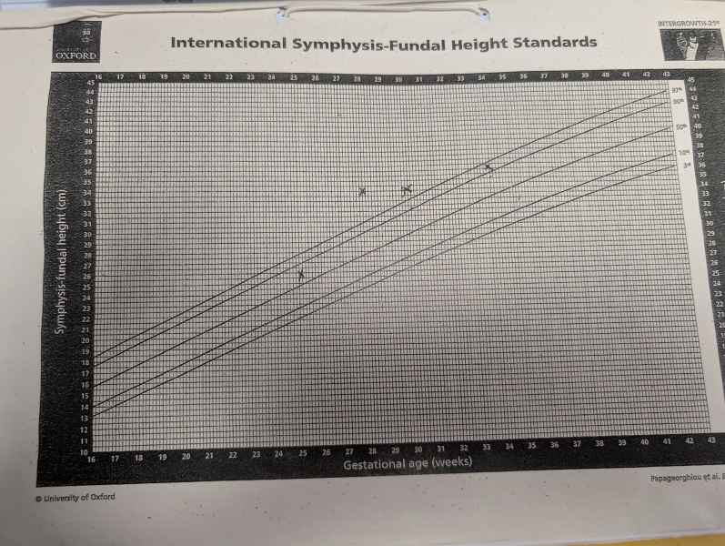 Fundal heigh confusion. Anyone been referred for a growth scan then cancelled?
