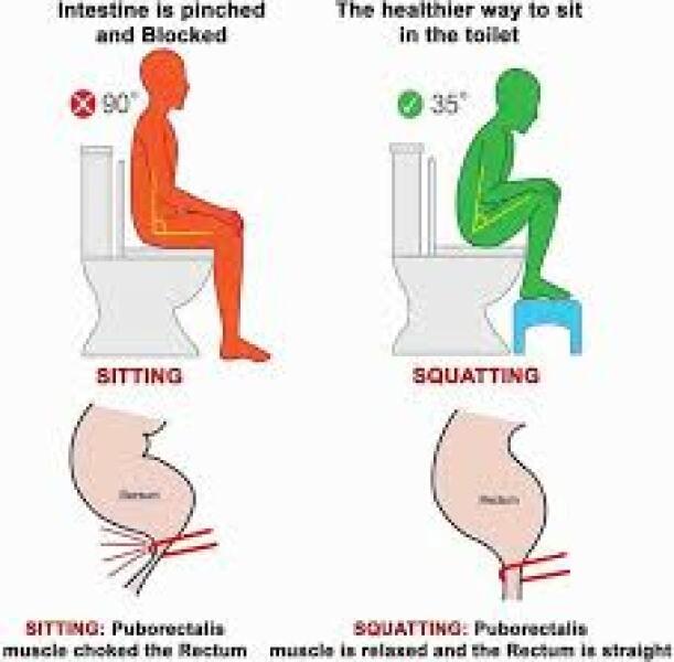 Would you stop the iron tablets?