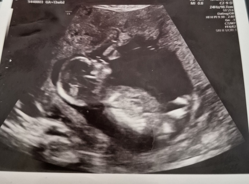 November 2025 #Thread 2 🤰🏻