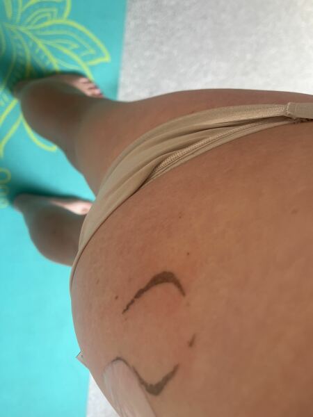 Patch residue!