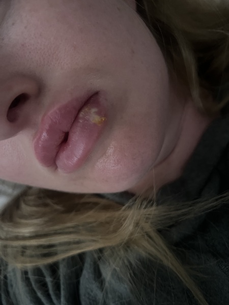 To wonder wtf this is on my lip