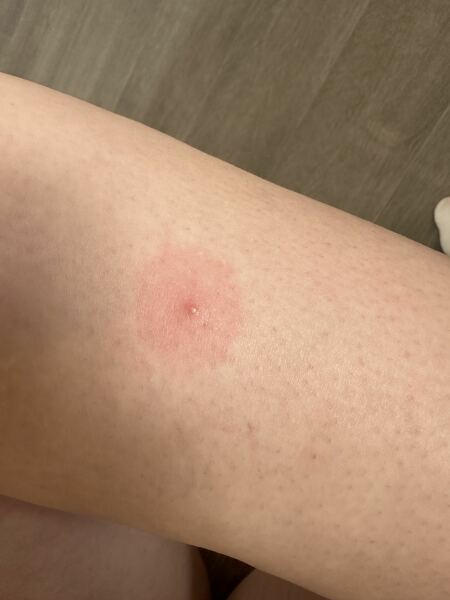 What is this on my leg?!