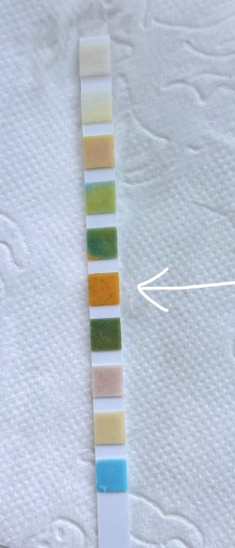 Urine dipstick blood