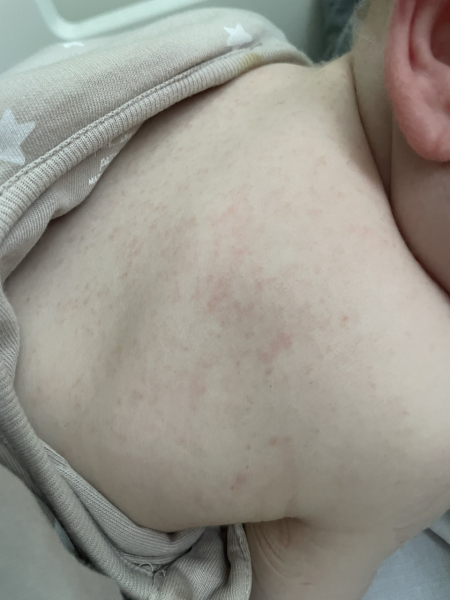 Handhold please - DS aged 1 been admitted to hospital with suspected sepsis