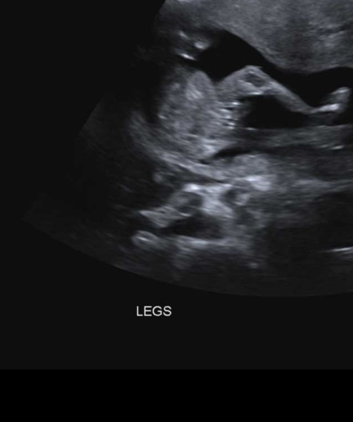 “Confirmed” nub theories