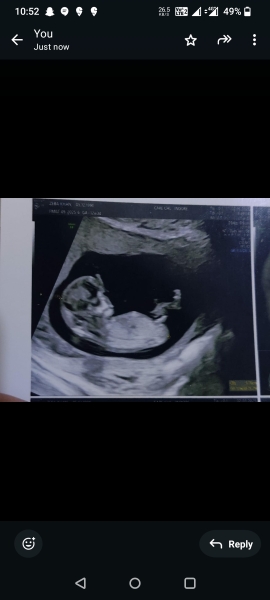 Has anyone had nub theory be wrong?