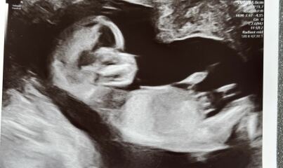 Gender guess??