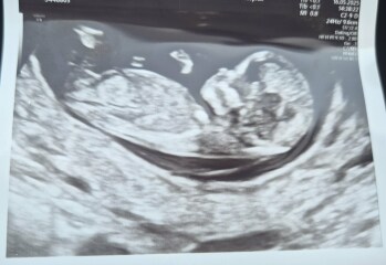 November 2025 #Thread 2 🤰🏻
