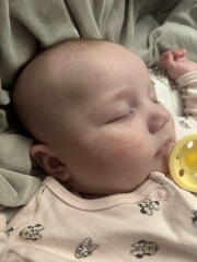 3 month old bad skin