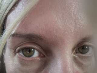 Eye help please