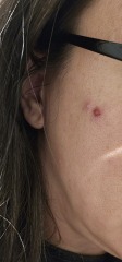 Is this just a spot or something to worry about?