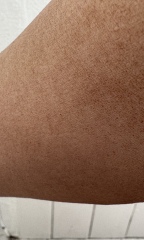 Having weird  issues with fake tan (images)