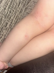 Undiagnosed skin condition