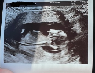 13 week scan, feeling worried