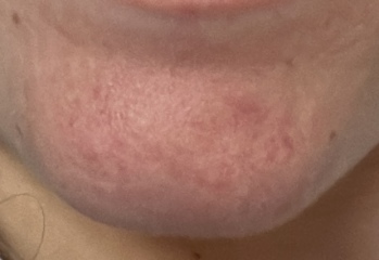 Skincare recommendations (pics!)