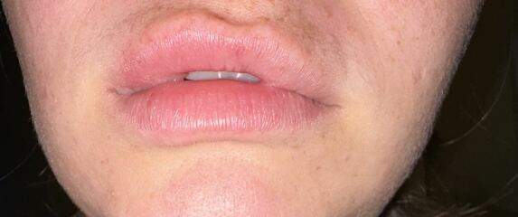 To wonder what kind of monster ulcer IS this…?! TW!
