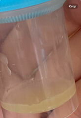 Colostrum